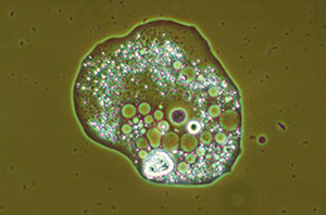 amoeba photo